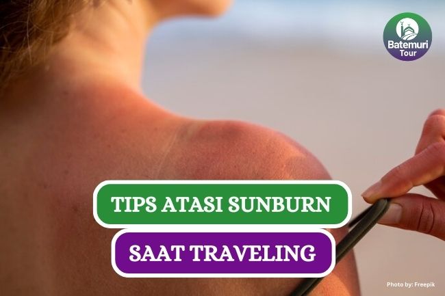 6 Tips Atasi Kulit Gosong Akibat Paparan Sinar Matahari saat Traveling